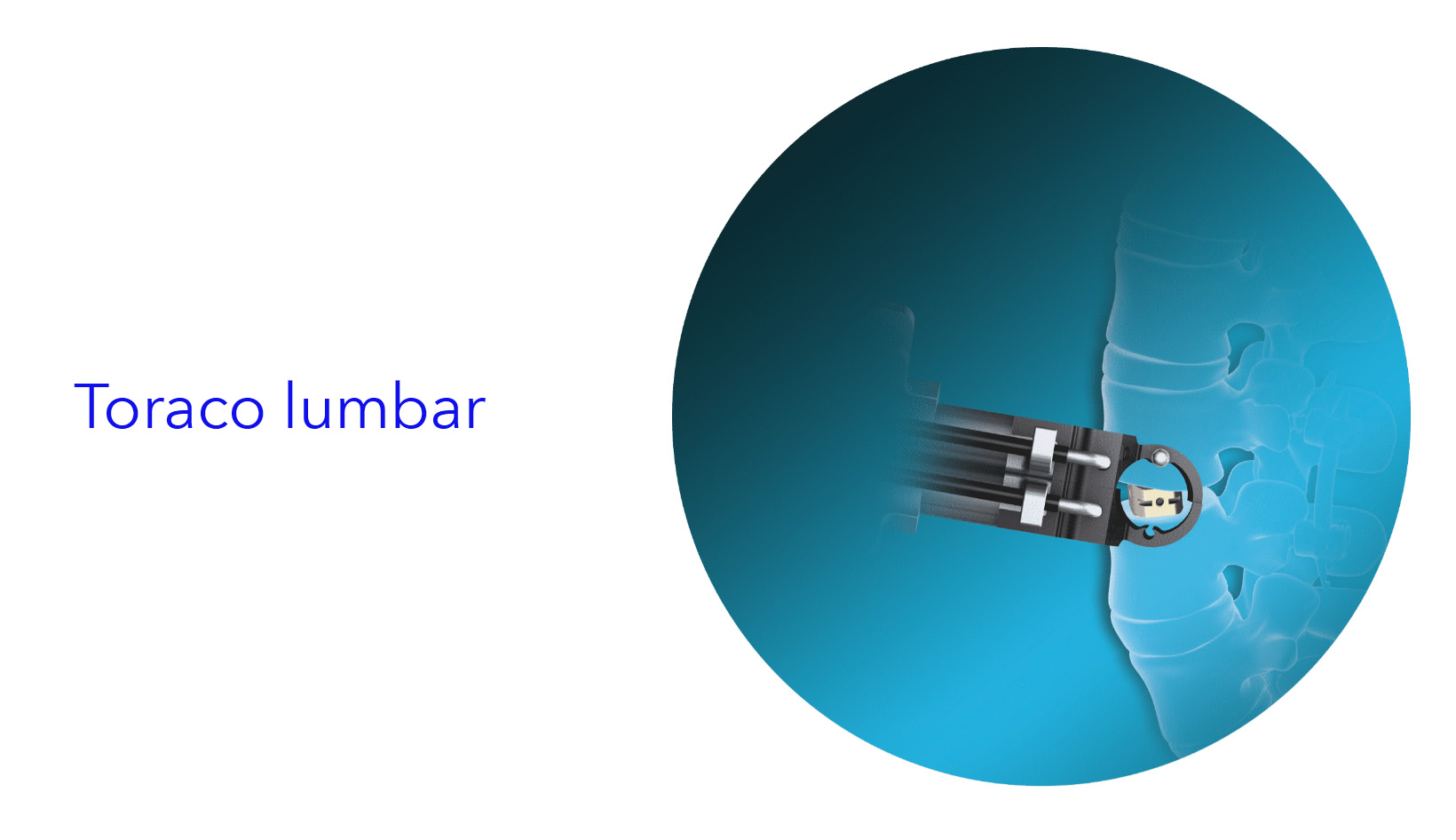 Curso toraco-lumbar 
